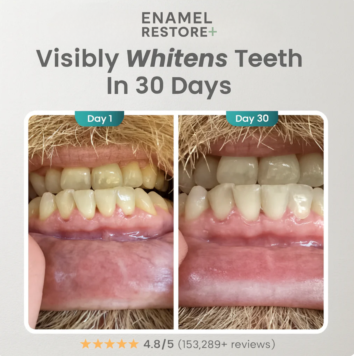 Enamel Restore+|  Nano-Hydroxyapatite toothpaste